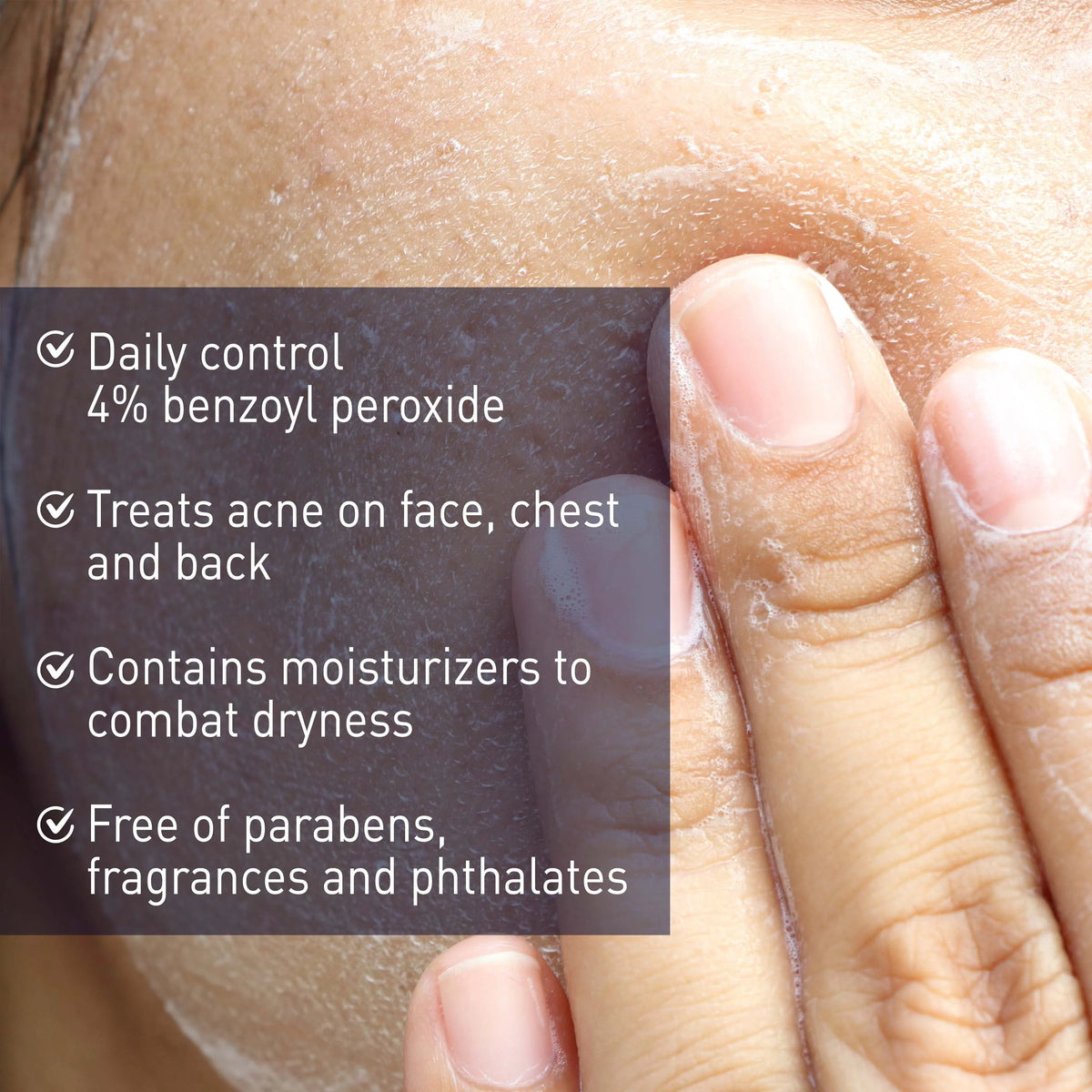 4% Benzoyl Peroxide Acne Creamy Wash L957