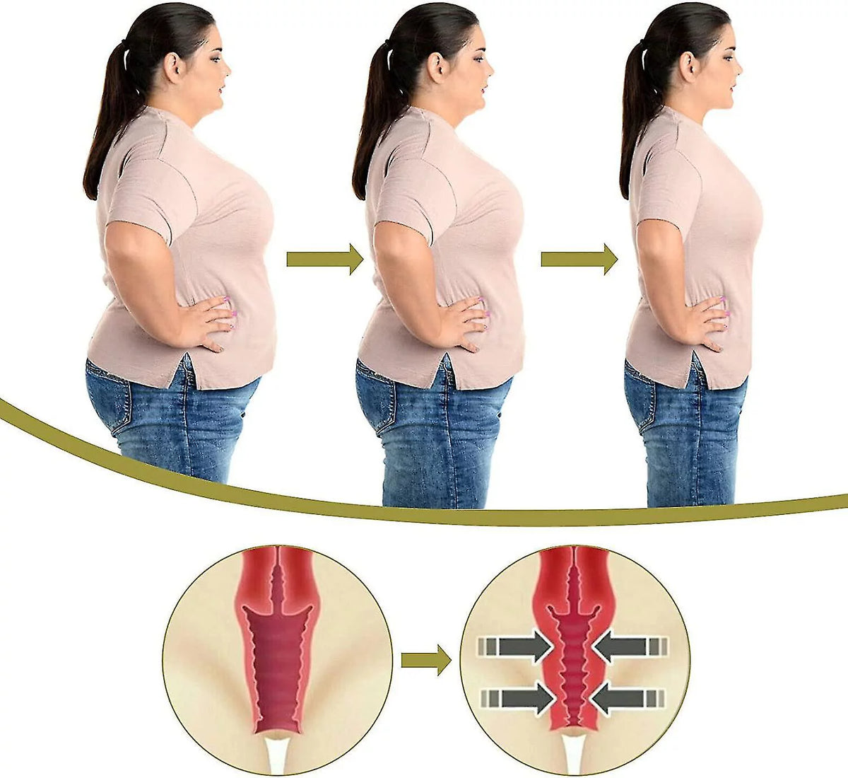 Anti-itch Slimming Capsules Q3529
